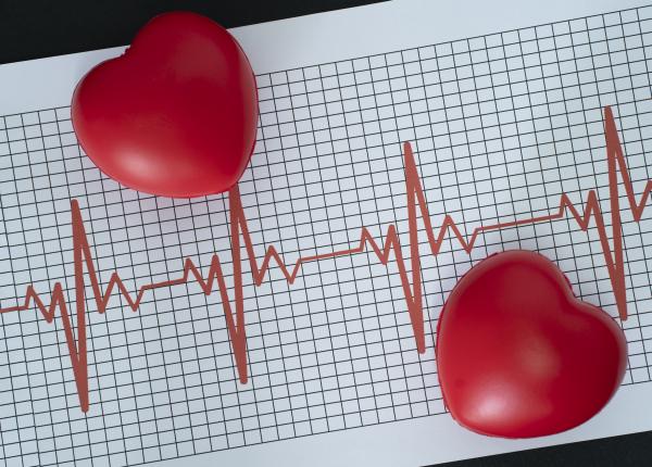 atac de cord vs stop cardiac cardiolog multa lume crede ca sunt acelasi lucru insa nu e chiar asa trebuie sa intelegeti ce se petrece in corp in fiecare dintre situatii
