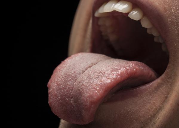 ai limba alba cinci boli de care ai putea suferi