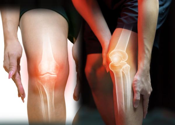 cele doua teste care iti arata daca ai osteoporoza calciu oase