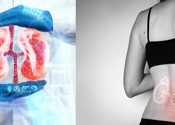 boala cronica de rinichi cauze factori de risc complicatii si tratament depistata tarziu poate duce la dializa sau transplant renal boala cronica de rinichi cauze factori de risc complicatii si tratament depistata tarziu poate duce la dializa sau transplant renal