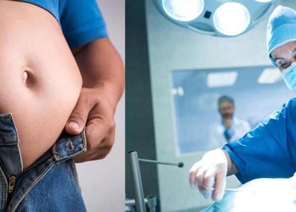 chirurgia bariatrica cui se adreseaza si care sunt complicatiile medic este o componenta a unui tratament multidisciplinar