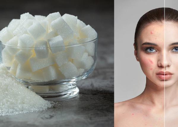 efectul nociv al zaharului aupra pielii dieta occidentala