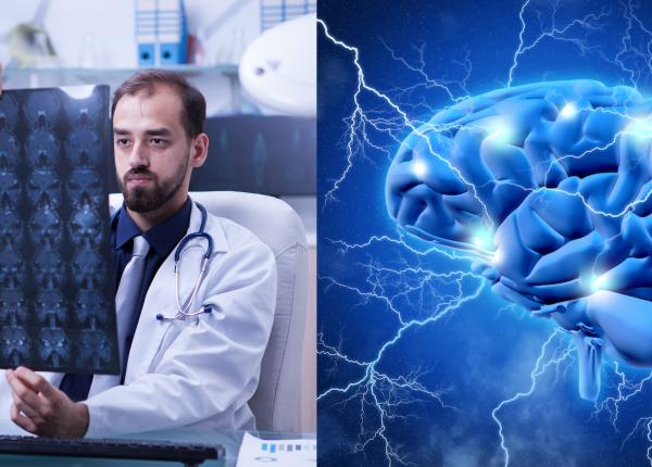 covid 19 impact asupra creierului ca la parkinson si alzheimer