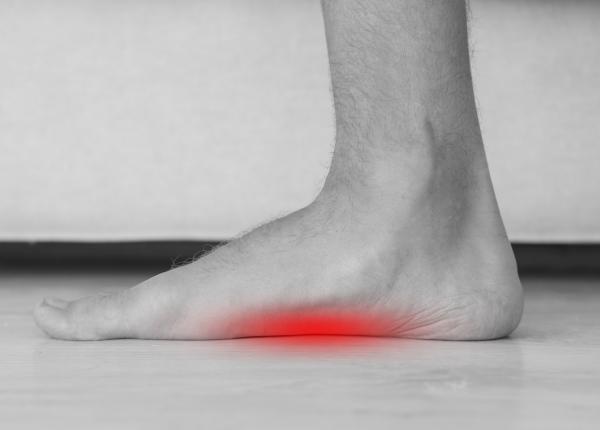 platfusul simptome cauze si factori de risc