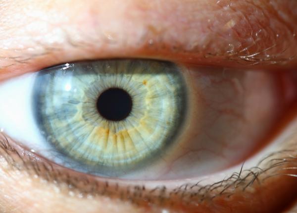 venele rosii din ochi cauze si tratament