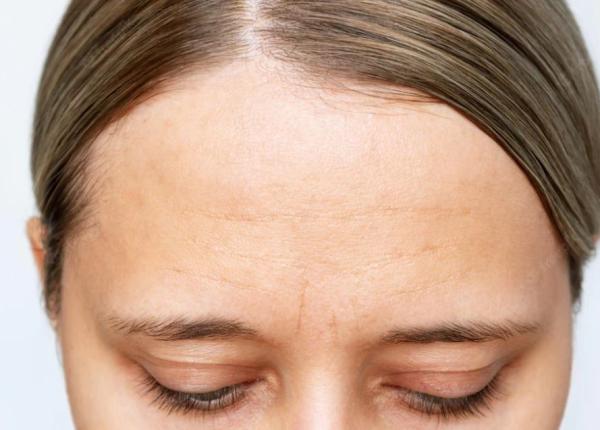 cele mai bune remedii pentru combaterea ridurilor