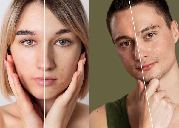 parazit responsabil cu infrumusetarea naturala