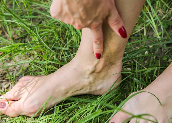 tromboza venoasa profunda boala fara varsta medic