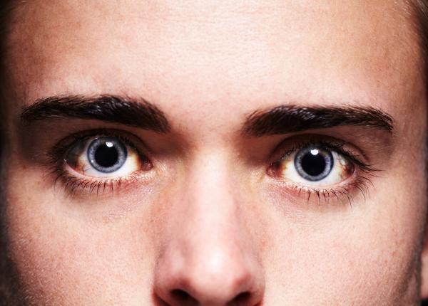 pupilele dilatate cauze si tratament