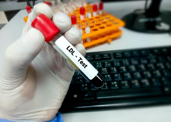 dislipidemia cauze factori de risc si tratament dislipidemia cauze factori de risc si tratament
