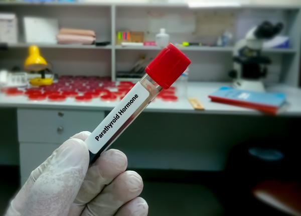 testul care iti arata daca ai hiperparatiroidism vladescu tratament