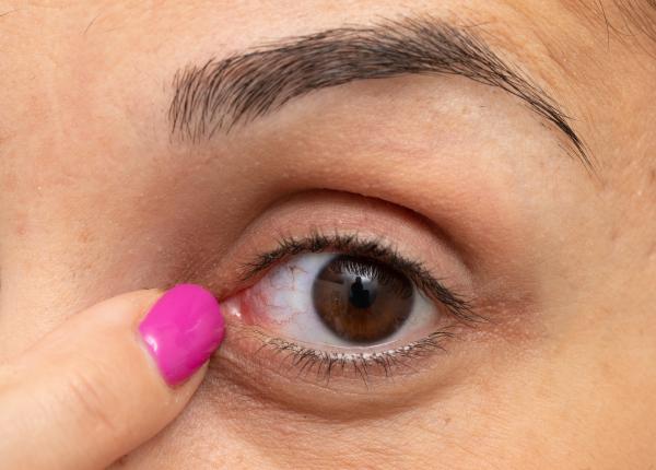 de ce te mananca ochii