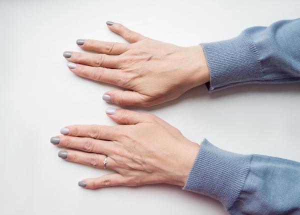 de ce te trezesti cu mainile umflate