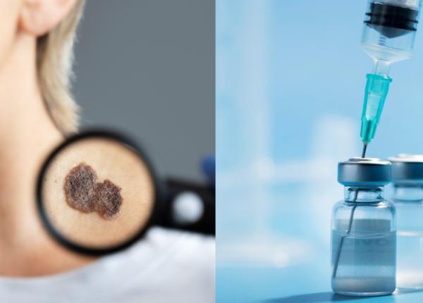 vaccinul impotriva cancerului de piele rezultate pozitive