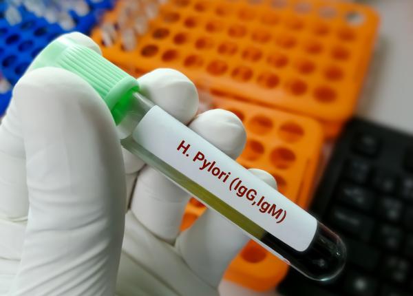 helicobacter pylori 12 lucruri cum stii daca o ai simptome alimente