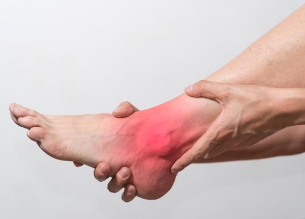 luxatie sau entorsa de glezna simptome tratament ce faci daca ai sucit glezna