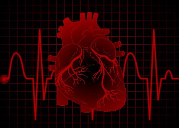 avc cardioembolic simptome cauze 2 varste cheagul de sange creier avc cardioembolic simptome cauze 2 varste cheagul de sange creier