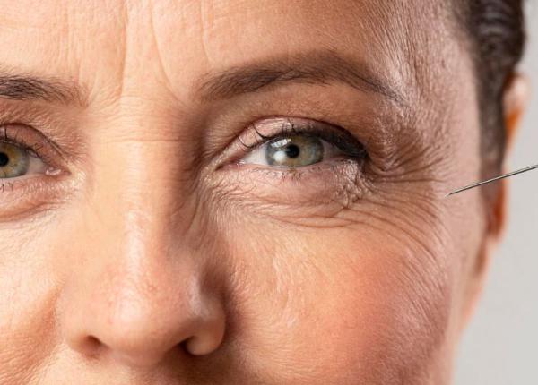 alimentele antirid care te intineresc cu 5 10 ani