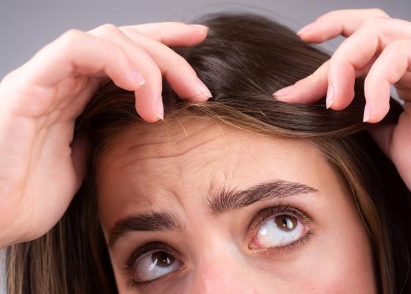 madaroza afectiunea care duce la pierderea parului