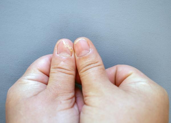 ingalbenirea unghiilor cum te ajuta pasta de dinti