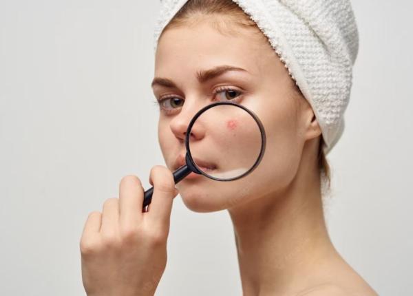 scapa de acnee opt obiceiuri pentru o piele curata si sanatoasa scapa de acnee opt obiceiuri pentru o piele curata si sanatoasa