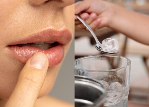 xerostomia gura uscata cauze si tratament