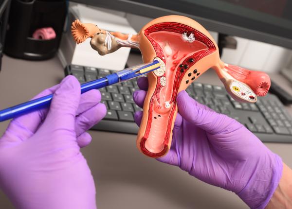 cancerul de col uterin tratament