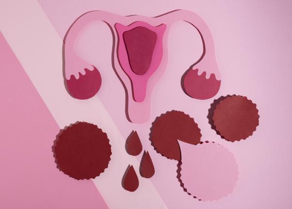 sindromul ovarelor polichistice cauze simptome tratament menstruatie herghelegiu ginecolog