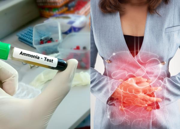 amoniacul implicat in raspunsul la tratamentul cancerului de colon