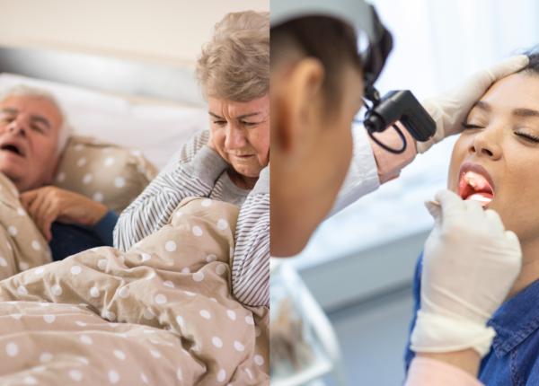 sforaitul cauze factori de risc si tratament