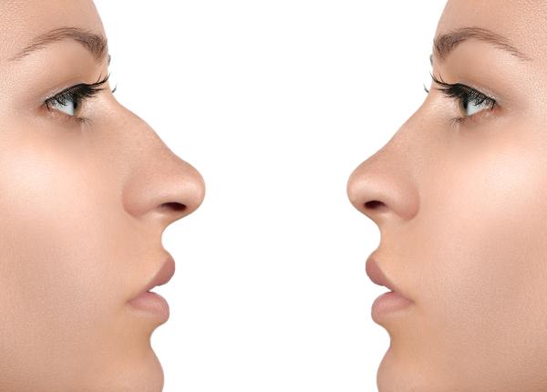 ce inseamna daca ai nasul mare ce inseamna daca ai nasul mare