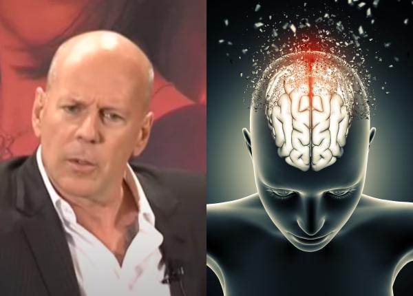 bruce willis dementa psihiatrul gabriel diaconu dementa romania