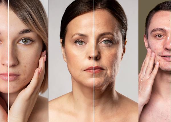 skin cycling ce este 3 etape produse marinescu