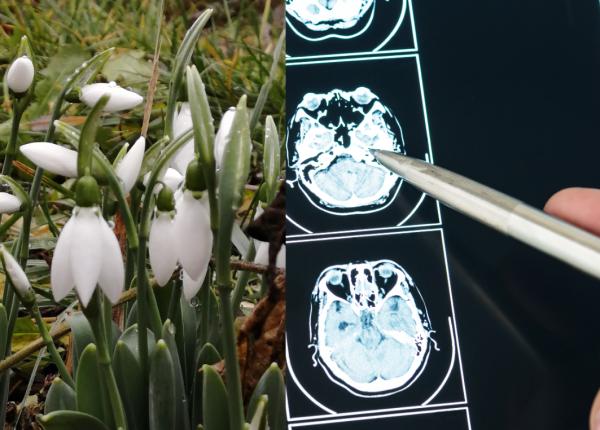 galantamina un compus prezent in ghiocei benefica in ameliorarea bolii alzheimer