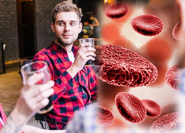 cele doua bauturi anevrism cerebral avc hemoragii grave