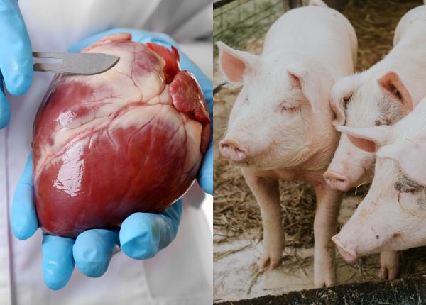 xenotransplantul transgenic ce este transplant de la porc xenotransplantul transgenic ce este transplant de la porc