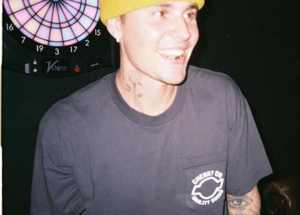 justin bieber diagnosticat cu sindromul ramsay hunt