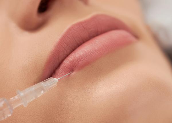 acidul hialuronic efect asupra buzelor acidul hialuronic efect asupra buzelor