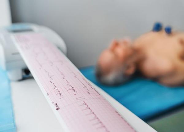 fibrilatia atriala asociata cu risc crescut de dementa