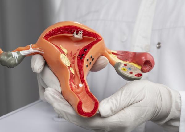 cancerul de col uterin boala unei tari slab dezvoltate fejer romania