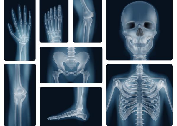 radiografiile intre riscuri si beneficii radiografiile intre riscuri si beneficii