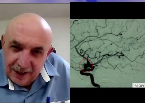 chirurgia bolilor vasculare cerebrale dr corneliu toader la academia de sanatate chirurgia bolilor vasculare cerebrale dr corneliu toader la academia de sanatate