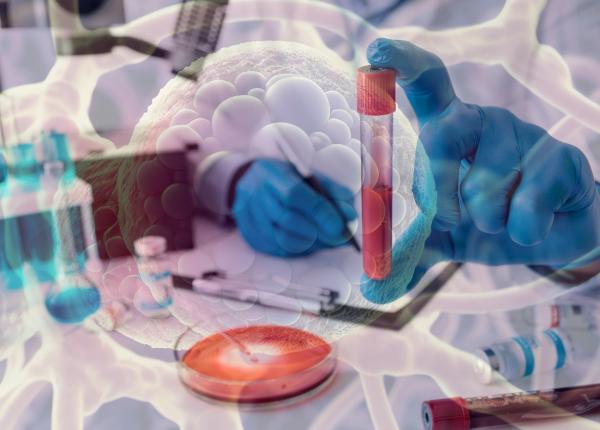 tracc testul care detecteaza cancerul prin probe de sange tracc testul care detecteaza cancerul prin probe de sange