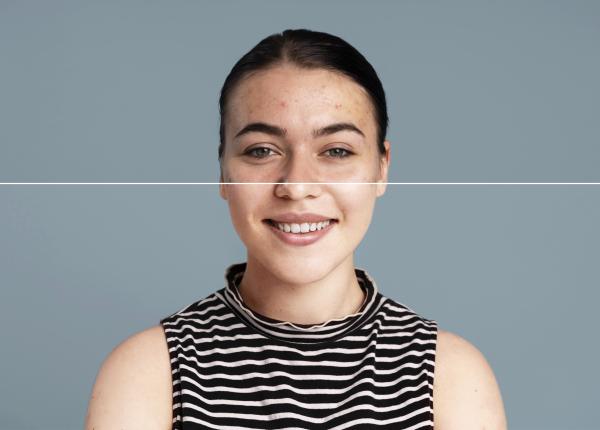 tonul si subtonul pielii ce sunt care este diferenta intre ele