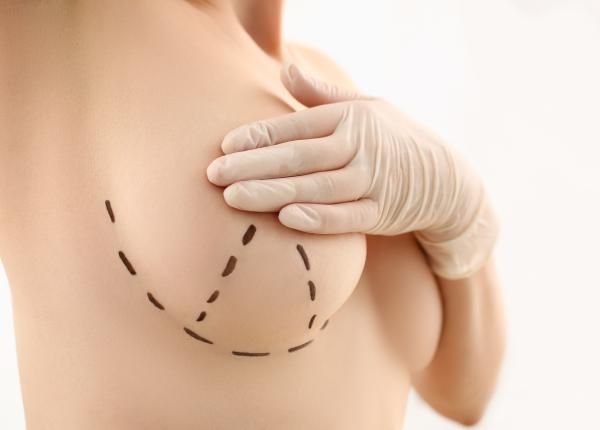 semne cancer san nicio femeie sa le ignore semne cancer san nicio femeie sa le ignore