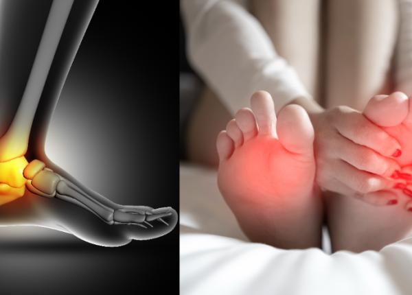 dureri de picioare noaptea cauze simptome tratament 8 afectiuni