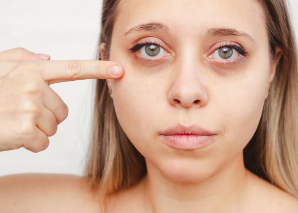 ochii umflati bolile pe care le pot ascunde