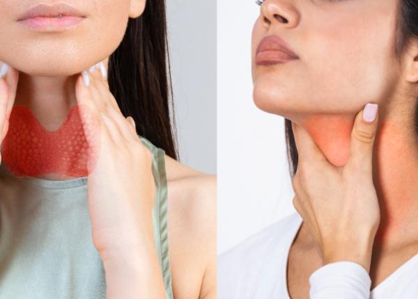 testul simplu care iti arata daca ai probleme cu tiroida nodul tiroidian t3 t4 tsh