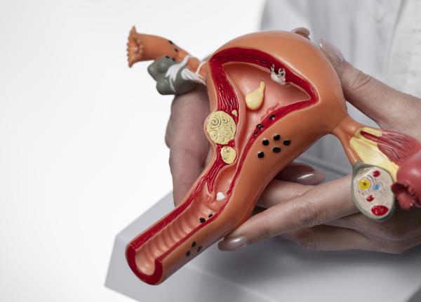 polipii uterini mai frecventi dupa menopauza polipii uterini mai frecventi dupa menopauza