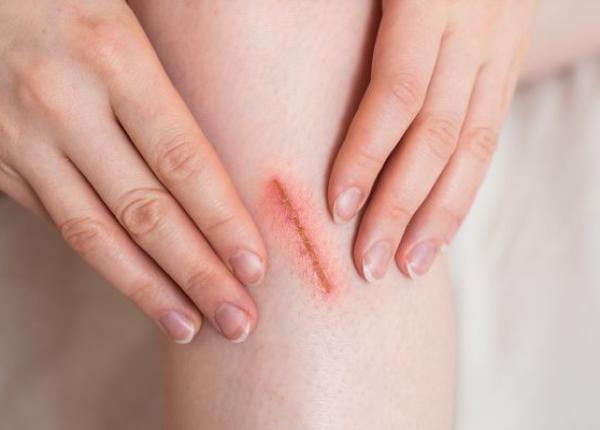 viata fara durere experimentata de o femeie sufera de o boala foarte rara